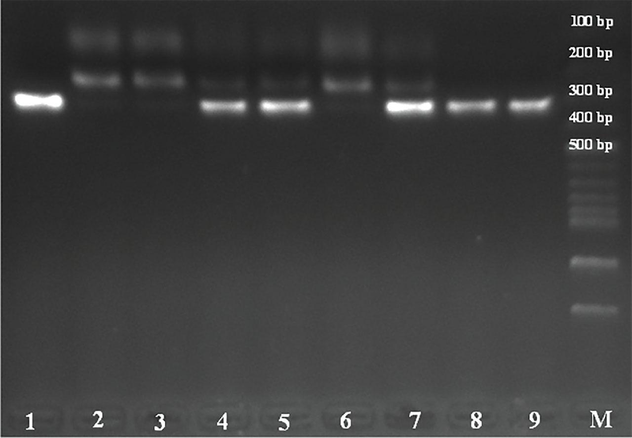 Electrophoresis of AT2R A1675G (rs14035430) gene polymorphism by enzyme digestion product sizes were 310 bp for AA genotype, 104 bp–206 bp–310 bp for AG genotype, and 104 bp–206 bp for GG genotype. Lanes 1, 8, and 9 are the AA genotype; lanes 4, 5, and 7 are the AG genotype; lanes 2, 3, and 6 are the GG genotype. AT2R, angiotensin II type 2 receptor; M, DNA molecular weight marker.