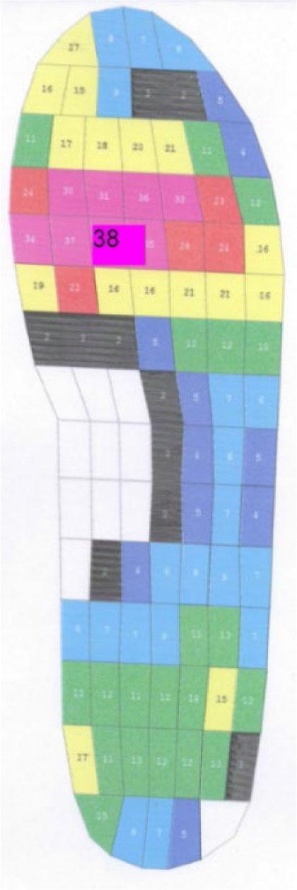 Plantar pressure in footwear without any insole (source: own research)