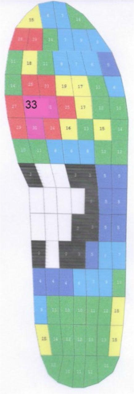 Plantar pressure in shoes with an insole made of 2 mm thick latex. (source: own research)