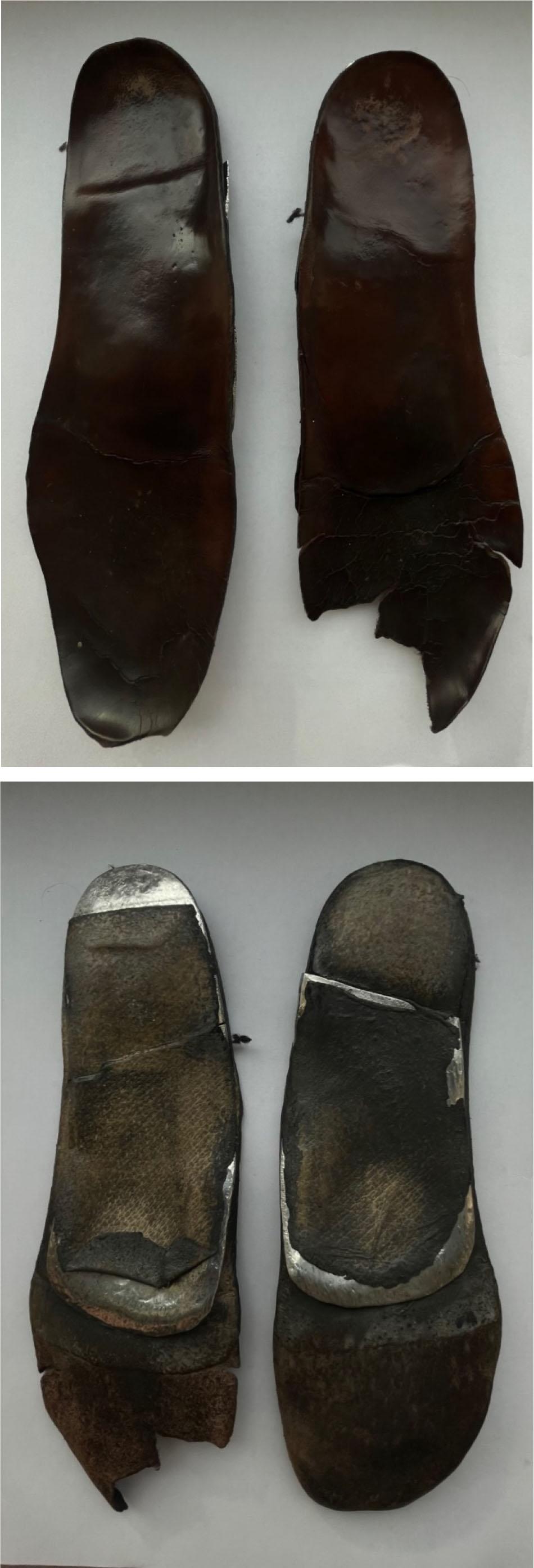 Individually designed insole for diabetics made in 90-ies. (source: own research)