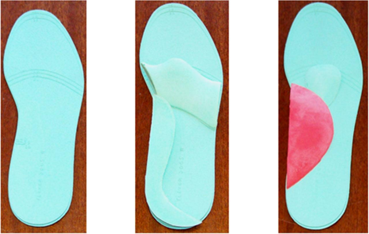 Elements for the construction of individual insoles based on various prefabricated elements (source: own research)