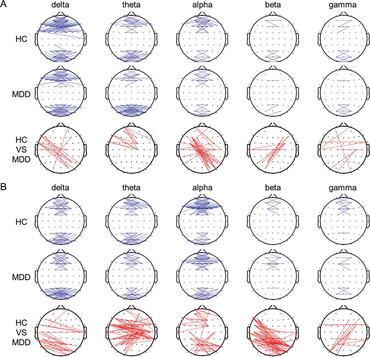 Grand functional connection maps of the left–right coherence between the pairs of electrodes at the threshold of 0.6 for different frequency bands during the OE (A) and CE (B) conditions. Red lines in the bottom panels denote significant differences between groups (P < 0.05). CE, eyes-closed; OE, eyes-open.