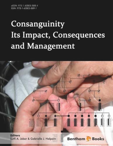 Consanguinity - Its Impact Consequences and Management