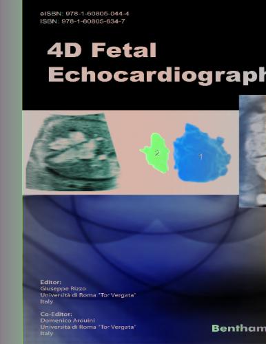 4D Fetal Echocardiography