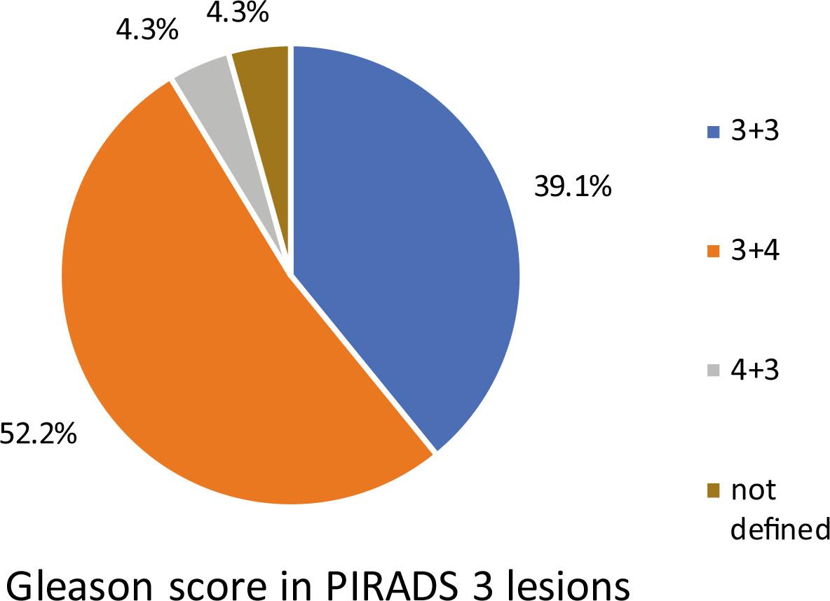 Gleason score of Prostate Imaging-Reporting and Data System (PIRADS) 3 positive biopsy (BX) lesions.