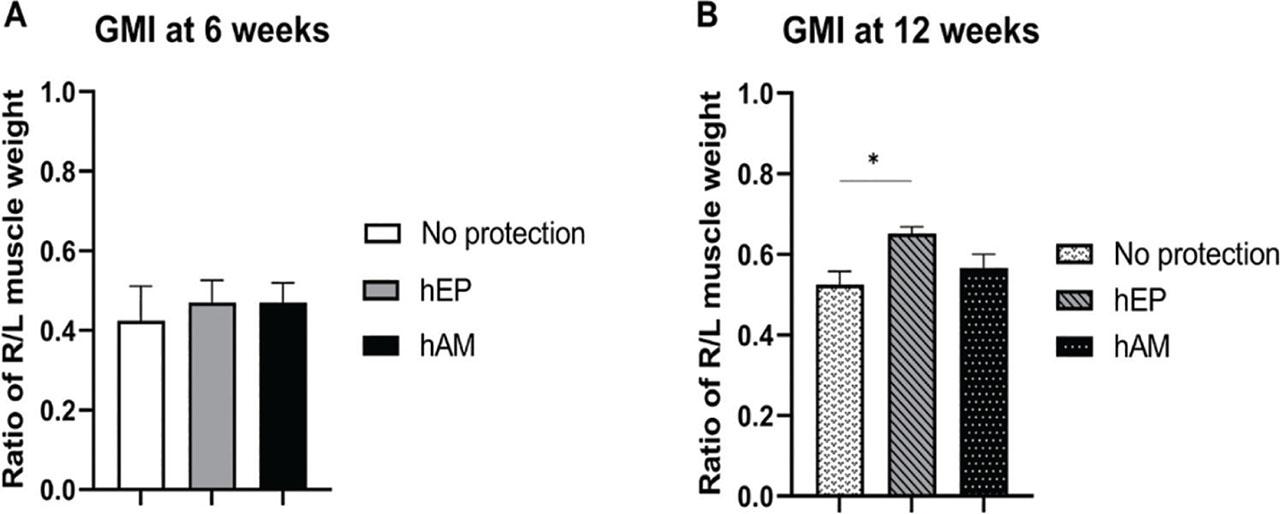 Evaluation of muscle denervation atrophy by GMI. (a) At 6 weeks, no significant differences in the GMI were observed between groups. (b) In contrast, at 12 weeks, the hEP group exhibited a significantly higher GMI compared with the No protection group. Data are presented as mean ± SEM. Statistical significance was determined using a one-way ANOVA test for group comparisons, with significance levels as follows: *p < 0.05, **p < 0.01, ***p < 0.001, and ****p < 0.0001. GMI, gastrocnemius muscle index; hAM, human amniotic membrane; hEP, human epineural patch; SEM, standard error of the mean.