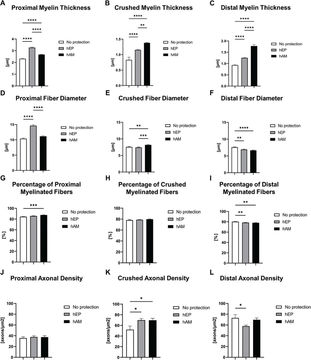 Histological assessment of the proximal, crushed, and distal parts of the injured segment at 6 weeks after sciatic nerve crush injury followed by nerve transection and end-to-end repair. (a) Proximal myelin thickness, (b) Crushed myelin thickness, (c) Distal myelin thickness, (d) Proximal fiber diameter, (e) Crushed fiber diameter, (f) Distal fiber diameter, (g) Percentage of proximal myelinated fibers, (h) Percentage of crushed myelinated fibers, (i) Percentage of distal myelinated fibers, (j) Proximal axonal density, (k) Crushed axonal density, and (l) Distal axonal density. The data are presented as mean ± SEM and statistical significance was determined using a one-way ANOVA test for group comparisons, with significance levels denoted as *p < 0.05, **p < 0.01, ***p < 0.001, and ****p < 0.0001. hAM, human amniotic membrane; hEP, human epineural patch; SEM, standard error of the mean.