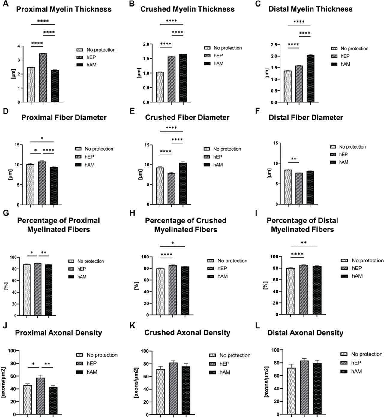 Histological assessment of the proximal, crushed, and distal parts of the injured segment at 12 weeks after sciatic nerve crush injury followed by nerve transection and end-to-end repair. (a) Proximal myelin thickness, (b) Crushed myelin thickness, (c) Distal myelin thickness, (d) Proximal fiber diameter, (e) Crushed fiber diameter, (f) Distal fiber diameter, (g) Percentage of proximal myelinated fibers, (h) Percentage of crushed myelinated fibers, (i) Percentage of distal myelinated fibers, (j) Proximal axonal density, (k) Crushed axonal density, and (l) Distal axonal density. The data are presented as mean ± SEM and statistical significance was determined using a one-way ANOVA test for group comparisons, with significance levels denoted as *p < 0.05, **p < 0.01, ***p < 0.001, and ****p < 0.0001. hAM, human amniotic membrane; hEP, human epineural patch; SEM, standard error of the mean.