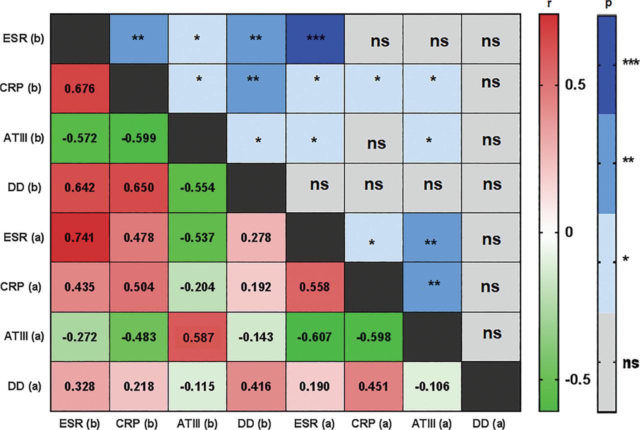 Correlation and p-value heatmap analysis between ESR before and after, CRP before and after, ATIII before and after, and DD before and after baricitinib therapy. p-values were expressed as follows: *0.05 > p > 0.01, **0.01 > p > 0.001, ***p < 0.001. ATIII, antithrombin III; CRP, C-reactive protein; DD, D-dimer; ESR, erythrocyte sedimentation rate; ns, not significant.