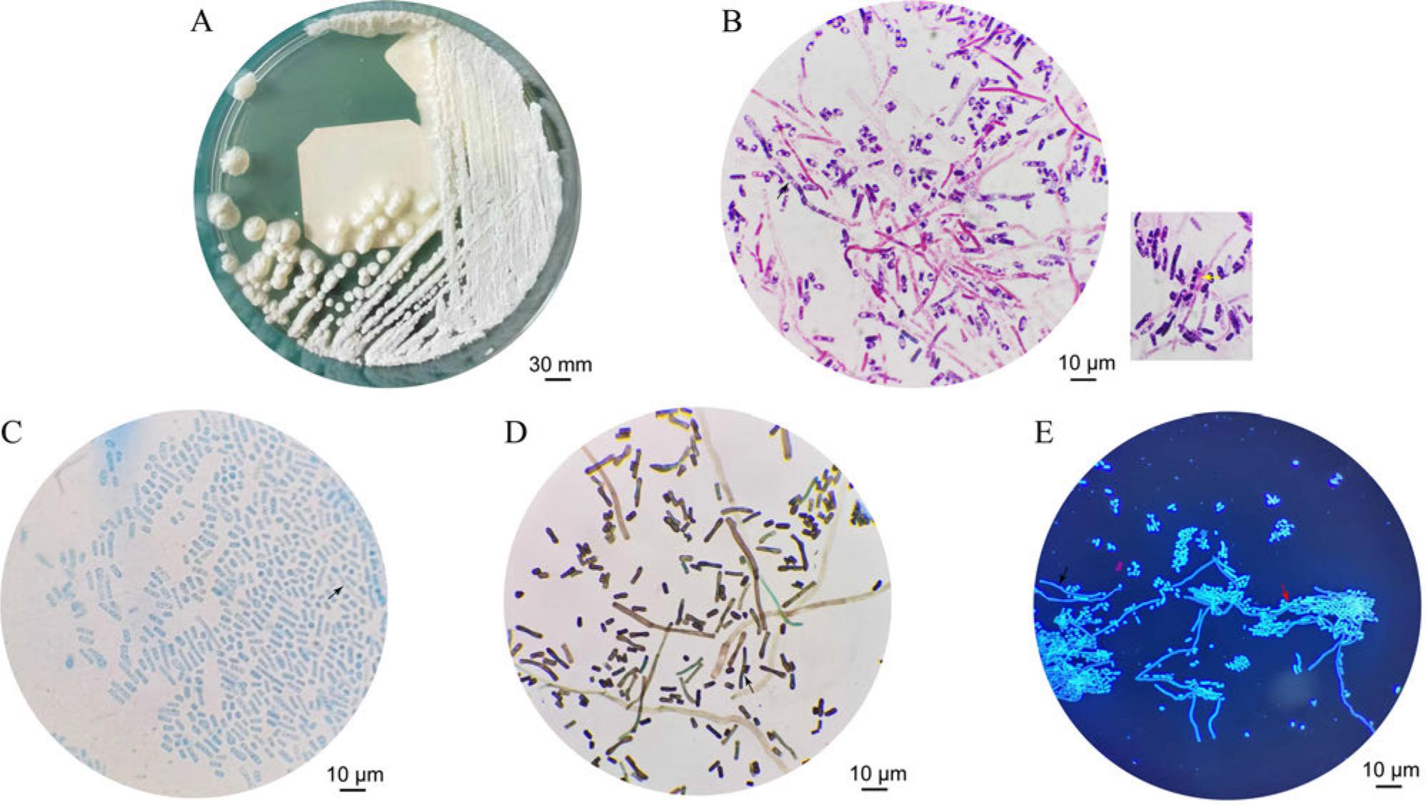 Morphology of the UB0827 strain: A) image after incubation on Sabouraud’s medium for 3 days; B) Gram staining under the microscope (1000× magnification); C) lactophenol cotton blue staining under the microscope (1000× magnification); D) hexamethylamine silver staining under the microscope (1000× magnification); E) fluorescent staining under the microscope (1000 magnification). Black arrows indicate the fungal filaments. Yellow arrows indicate the potential arthrospores. Red arrows indicate the budding spores.