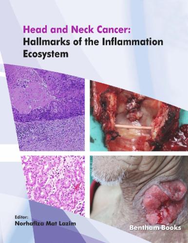 Head and Neck Cancer: Hallmarks of the Inflammation Ecosystem