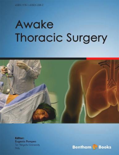 Awake Thoracic Surgery
