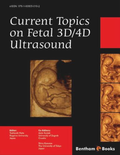 Current Topics on Fetal 3D/4D Ultrasound