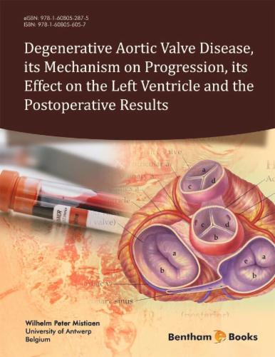 Degenerative Aortic Valve Diseaseits Mechanism on Progressionits Effect on the Left Ventricle and the Postoperative Results