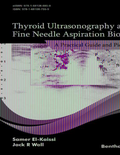 Thyroid Ultrasonography and Fine Needle Aspiration Biopsy: A Practical Guide and Picture Atlas