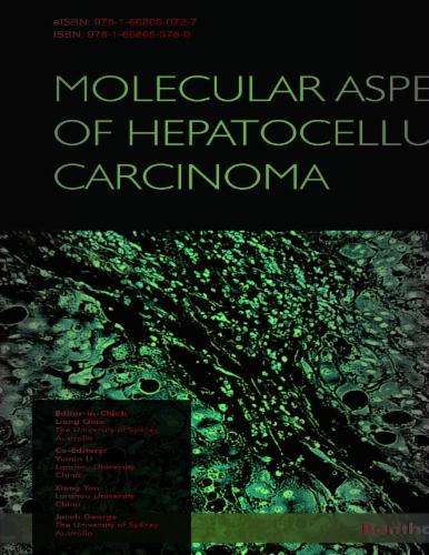 Molecular Aspects of Hepatocellular Carcinoma