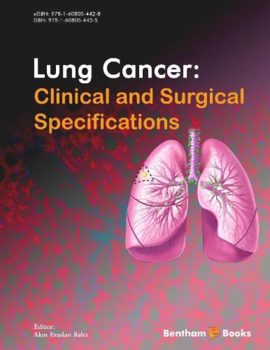 Lung Cancer: Clinical and Surgical Specifications