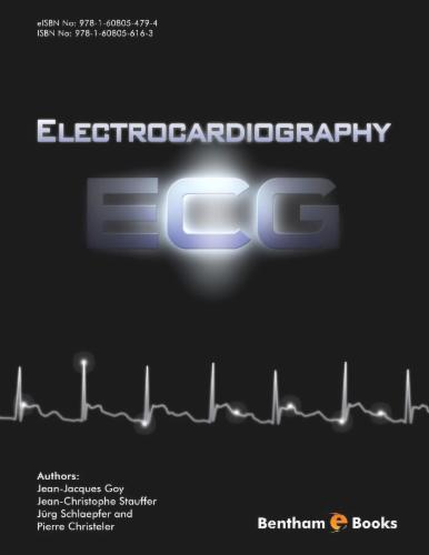 Electrocardiography (ECG)