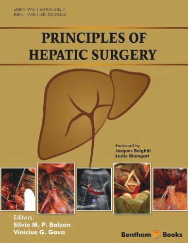 Principles of Hepatic Surgery