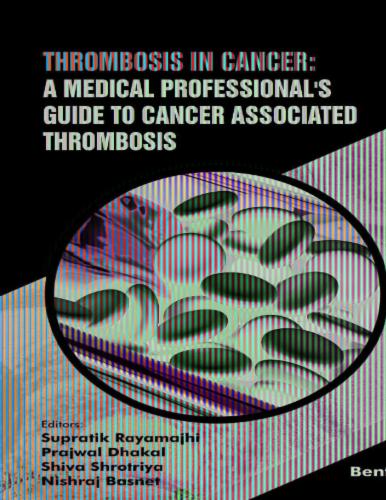 Thrombosis in Cancer: A Medical Professional's Guide to Cancer Associated Thrombosis