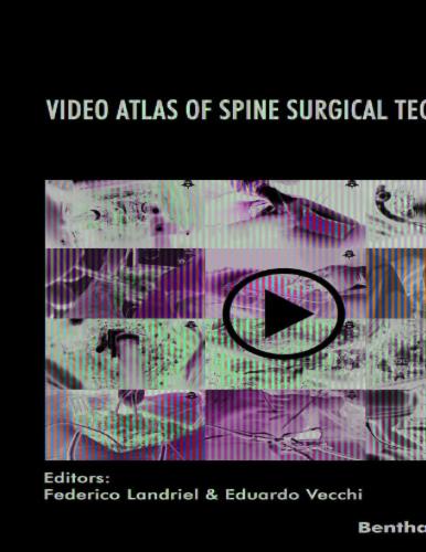 Video Atlas of Spine Surgical Techniques