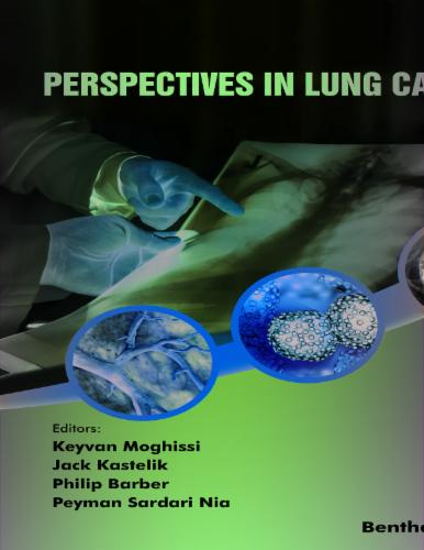 Perspectives in Lung Cancer