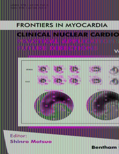 Clinical Nuclear Cardiology: Practical Applications and Future Directions