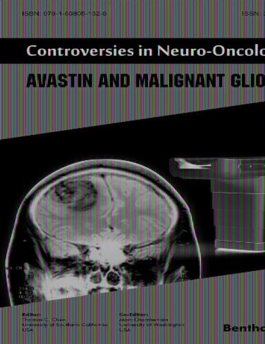 Controversies in Neuro-Oncology: Volume 1