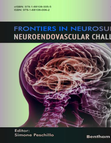 NeuroEndovascular Challenges