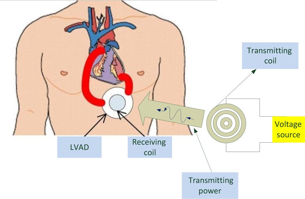 Wireless power transfer of LVAD.