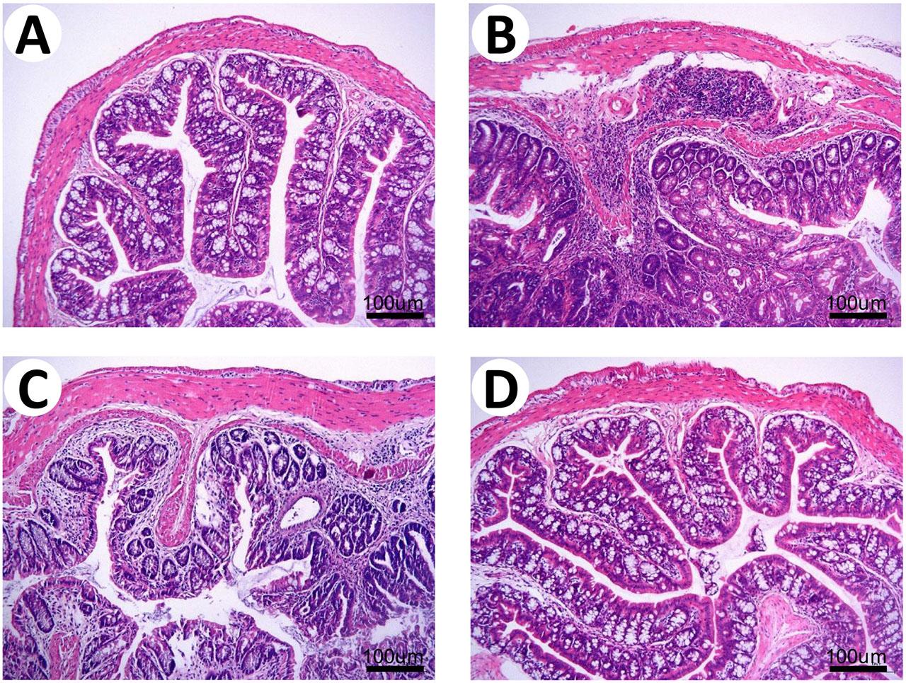 EGFR mAb treatment combined with EGF enema alleviates colonic inflammation in the IBD model in vivo. (A-D) Representative H&E staining images (100x) of colon tissue from control (A), AOM/DSS model (B), model with EGF enema (C) and model with EGF enema and EGFR mAb treatment (D)