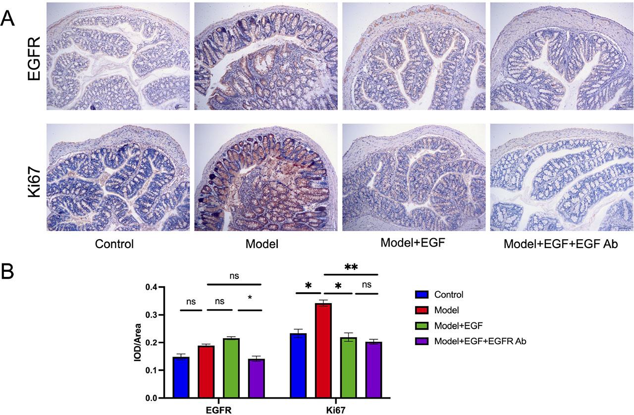 EGFR mAb treatment combined with EGF enema reduces proliferation in the IBD model in vivo. (A) IHC images (100x) showing changes in expression of Ki67 and EGFR among control, AOM/DSS model, model with EGF enema and model with EGF enema and EGFR mAb treatment. (B) Bar-graph showing quantification of staining in (A). Data is presented as mean ± SEM. *P<0.05, **P<0.01, ***P<0.001