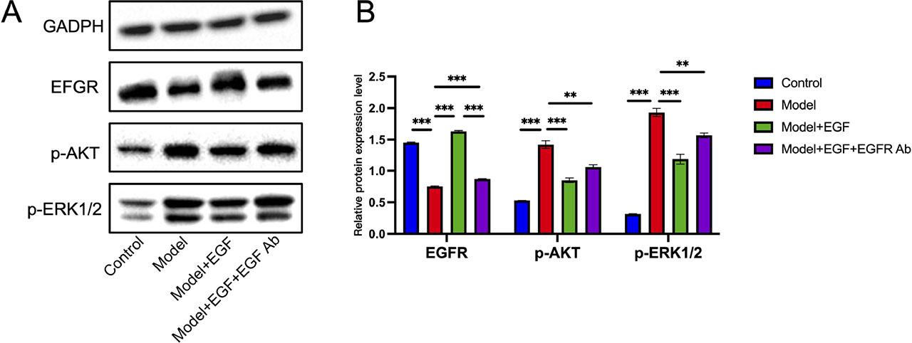 EGFR mAb treatment combined with EGF enema reduces oncogenic signaling in the IBD model in vivo. (A) Immunoblots showing changes in expression of p-AKT, p-ERK and EGFR among control, AOM/DSS model, model with EGF enema and model with EGF enema and EGFR mAb treatment. (B) Bar-graph showing quantification of changes in protein expression in (A). Data is presented as mean ± SEM. *P<0.05, **P<0.01, ***P<0.001