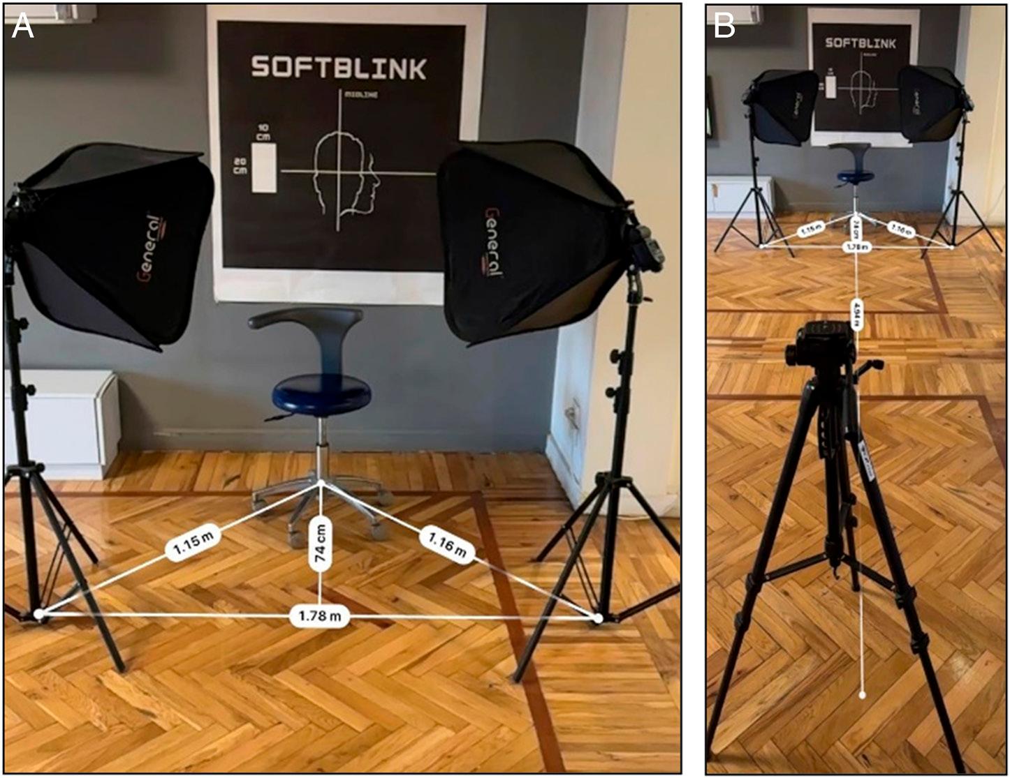 The Camera setup used in the study; The distance between the two soft boxes arms is (1.78 m), the distance between the arm of the soft box and the chair position is (1.16 m), the distance between the tripod holding camera and the chair position is (4.94 m).