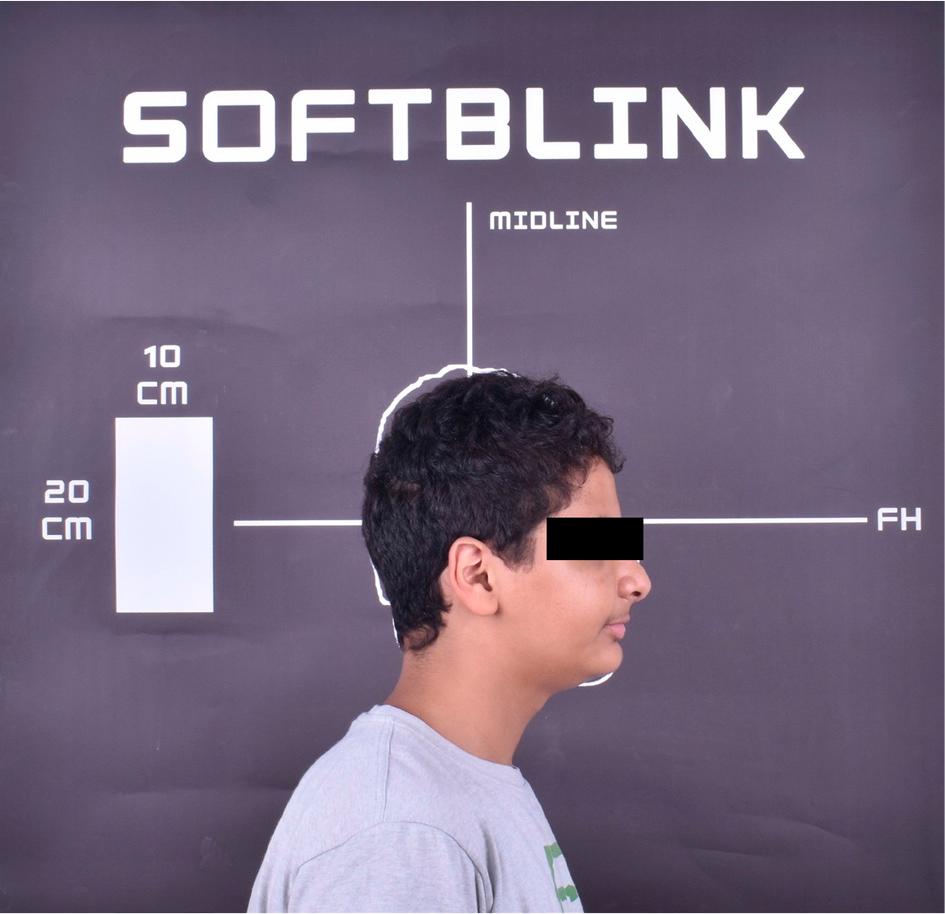 The newly designed SOFTBLINK banner used in the study.
