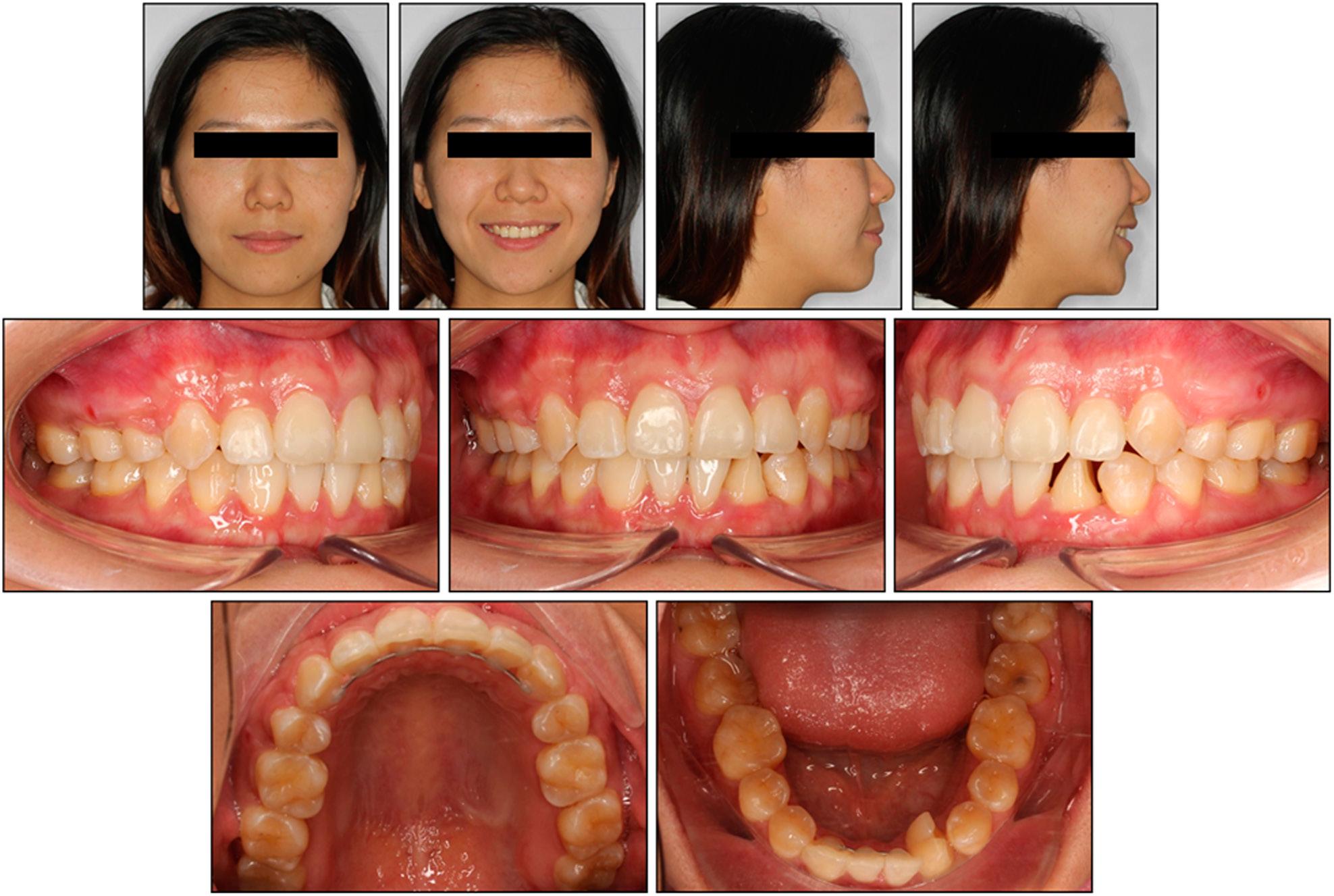Post-treatment extra- and intra-oral clinical photographs.