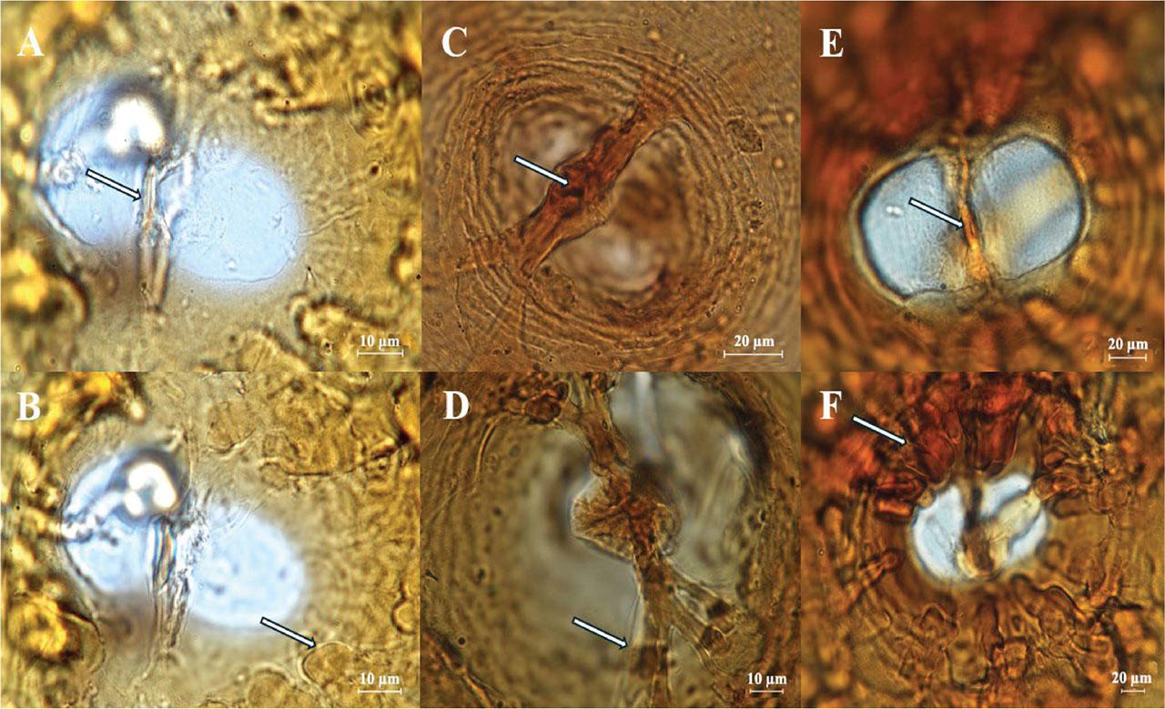 Photomicrographs of vulva cones of cyst showing vulva fenestra (all bifenstrate), vulva slit, bullae, and underbridge of Heterodera species, Avenae group. Heterodera filipjevi: (A) vulval slit (arrow) and underbridge; (B) Bullae (arrow); H. hordecalis: (C) vulval slit (arrow) and strong underbridge with bifurcate ends (arrow); (D) Bullae absent; H. mani: (E) vulval slit (arrow) and underbridge; (F) bullae (arrow). Images were captured at different focal planes to emphasize diagnostic features. Scale bars, A, B, D, 10μm; C, E, F, 20 μm.
