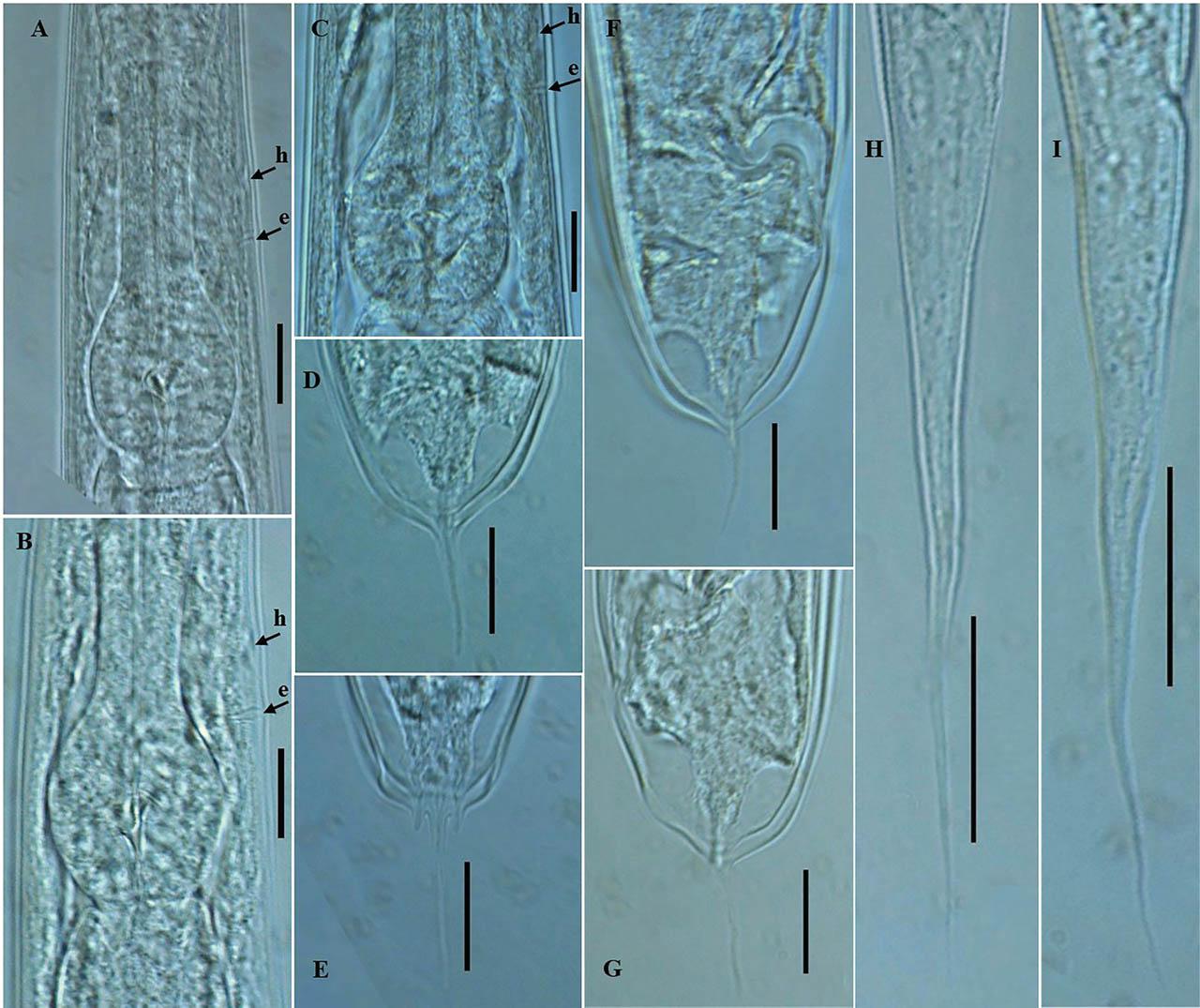 Photomicrographs of P. koreana n. sp. (A–I). (A–C) Posterior region of the pharynx; (D,F,G) female tail region, (E) caudal part with prominent phasmids; and (H,I) dauer juvenile tail. The arrows labeled h and e indicate the position of hemizonid and excretory pore, respectively, (scale bars: A–G = 20 μm; H,I = 30 μm).