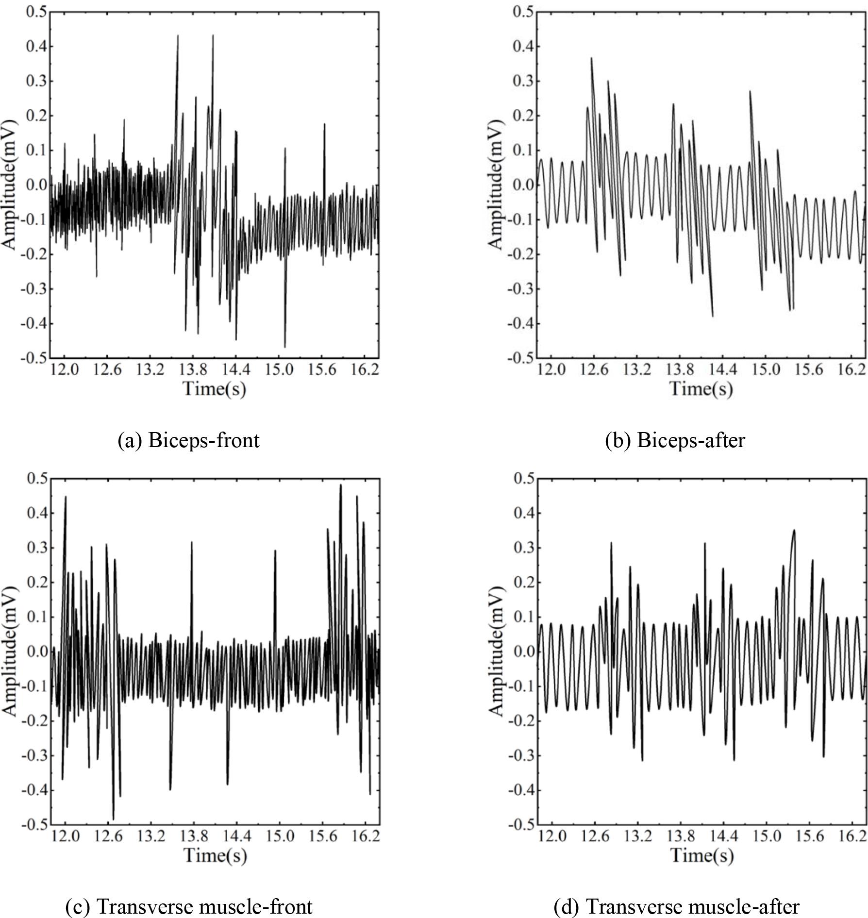 Muscle electrical signal feature extraction results