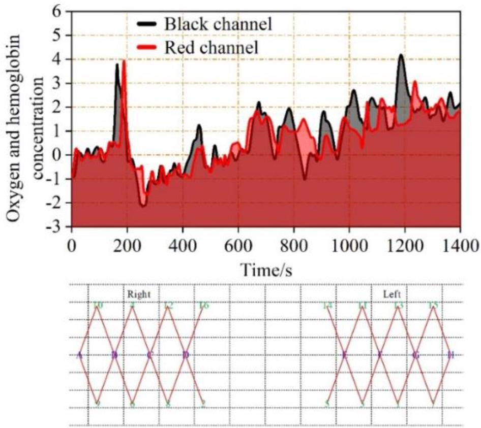 The sequence of changes in concentration of oxygen and hemoglobin