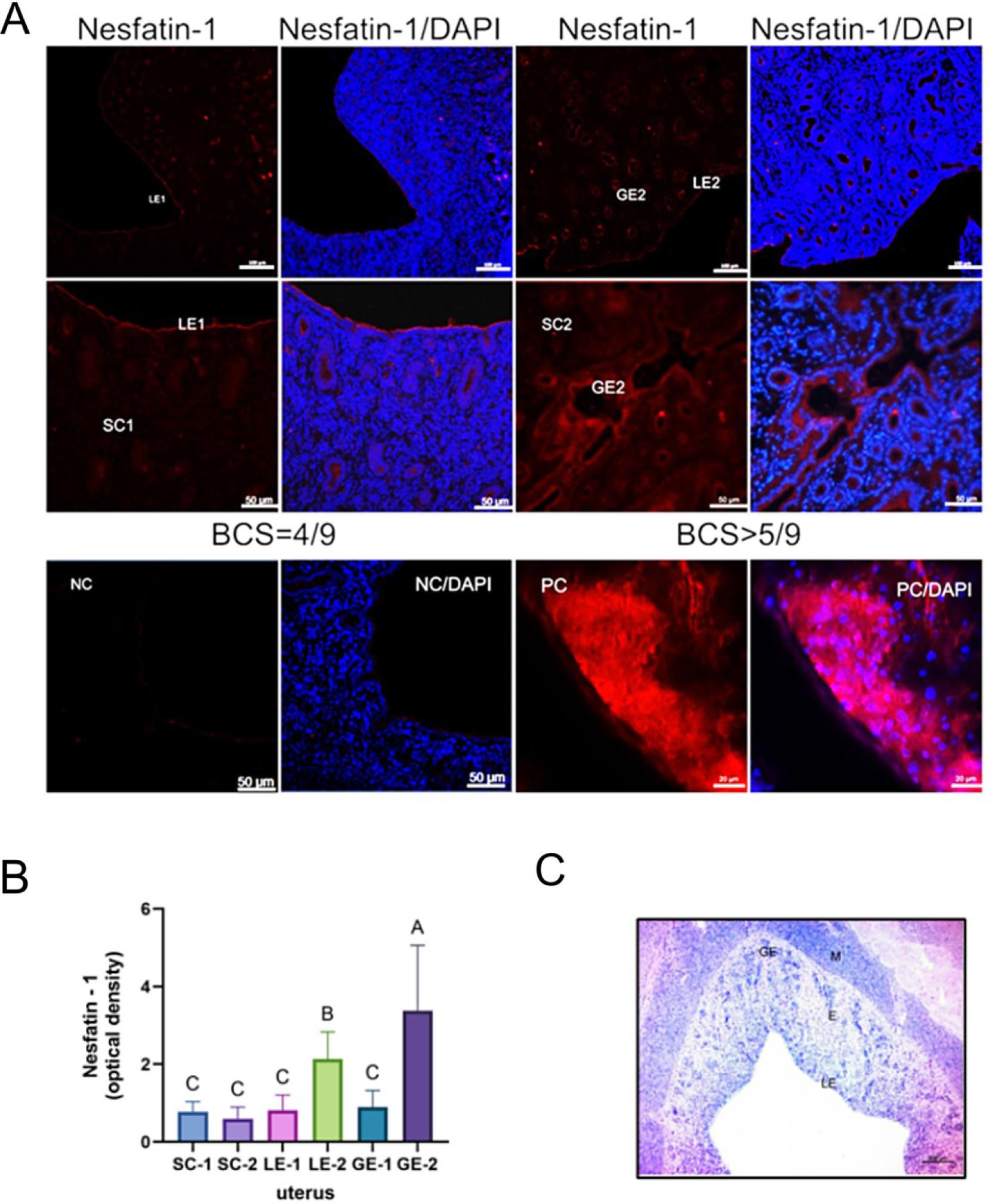 A – Representative canine uterus sections showing nesfatin-1 localisation (in red) and cell nuclei stained by 4′,6-diamidino-2-phenylindole (DAPI – in blue). Signal detection of nesfatin-1 in the uteri of bitches with body condition score (BCS) = 4/9 (a and b) and overweight individuals with BCS > 5/9 (c and d). Scale bar – 100 μm (a and c), 50 μm (b, d and negative control (NC)), 20 μm (positive control (PC)). B – Level of nesfatin-1 immunoreactivity in the endometrial epithelium (LE), the glandular epithelium (GE), and endometrial stromal cells (SC). Bars represent the mean level of neuropeptide immunoreactivity ± standard deviation. A, B and C – statistically significant difference between groups at P-value < 0.05. LE-1, GE-1 and SC-1 – dogs with BCS = 4/9; LE-2, GE-2 and SC-2 – dogs with BCS > 5/9. C – Representative photomicrograph of histological staining with haematoxylin and eosin of a uterine section from a healthy female dog in the dioestrous phase; M – myometrium; E – endometrium; Scale bar – 200 μm