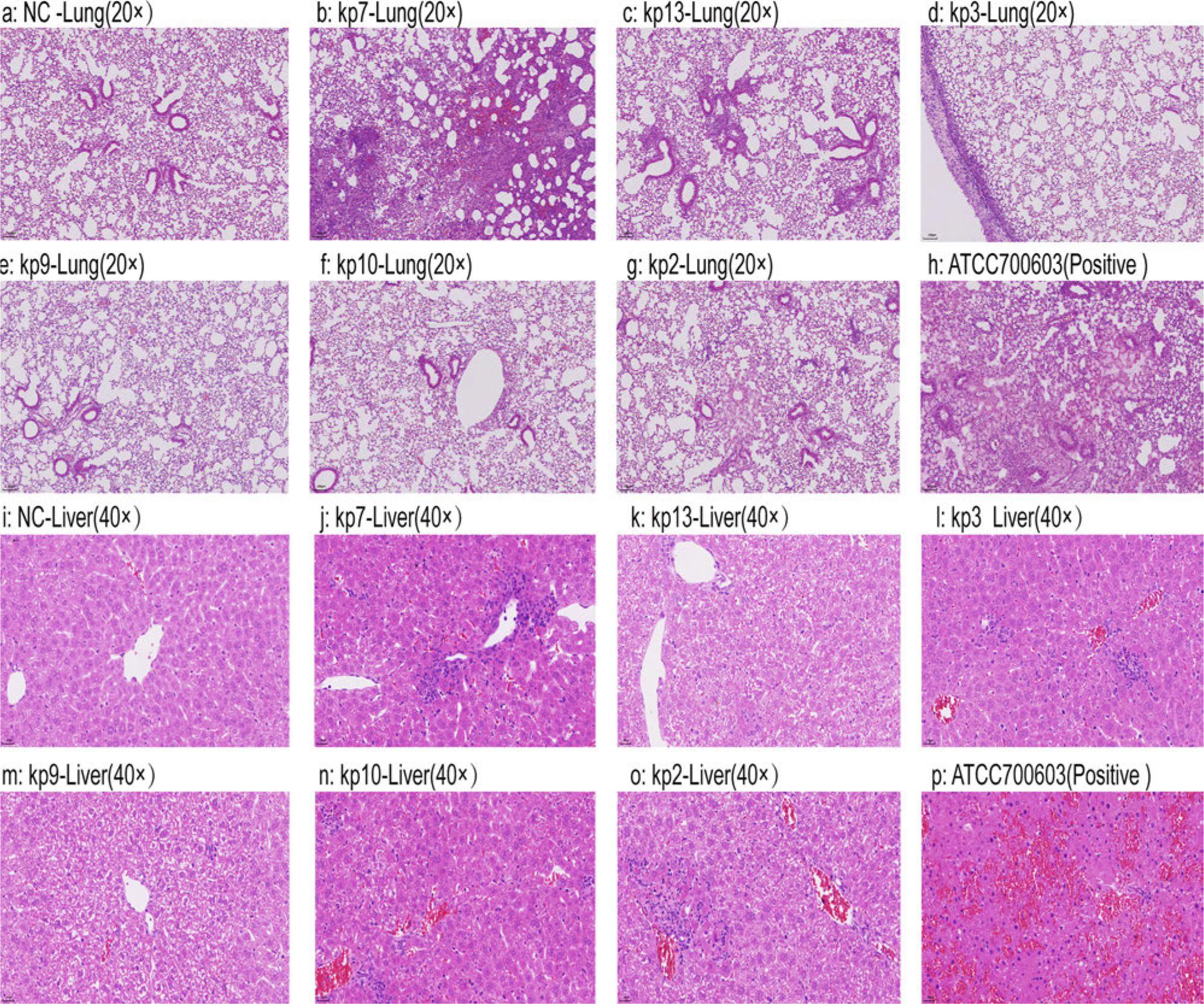 Histopathological impact of ST231 isolates on mouse tissues.
The images, stained with hematoxylin and eosin, reveal significant tissue damage, particularly in the lungs (b–g) and livers (j–o), where extensive cellular infiltration and structural disruption are evident. Renal injury was not significant, and data are not shown.