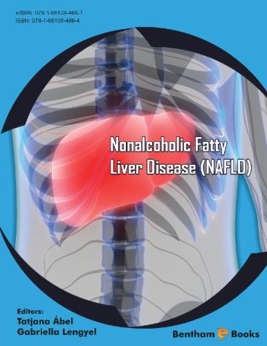 Nonalcoholic Fatty Liver Disease (NAFLD)