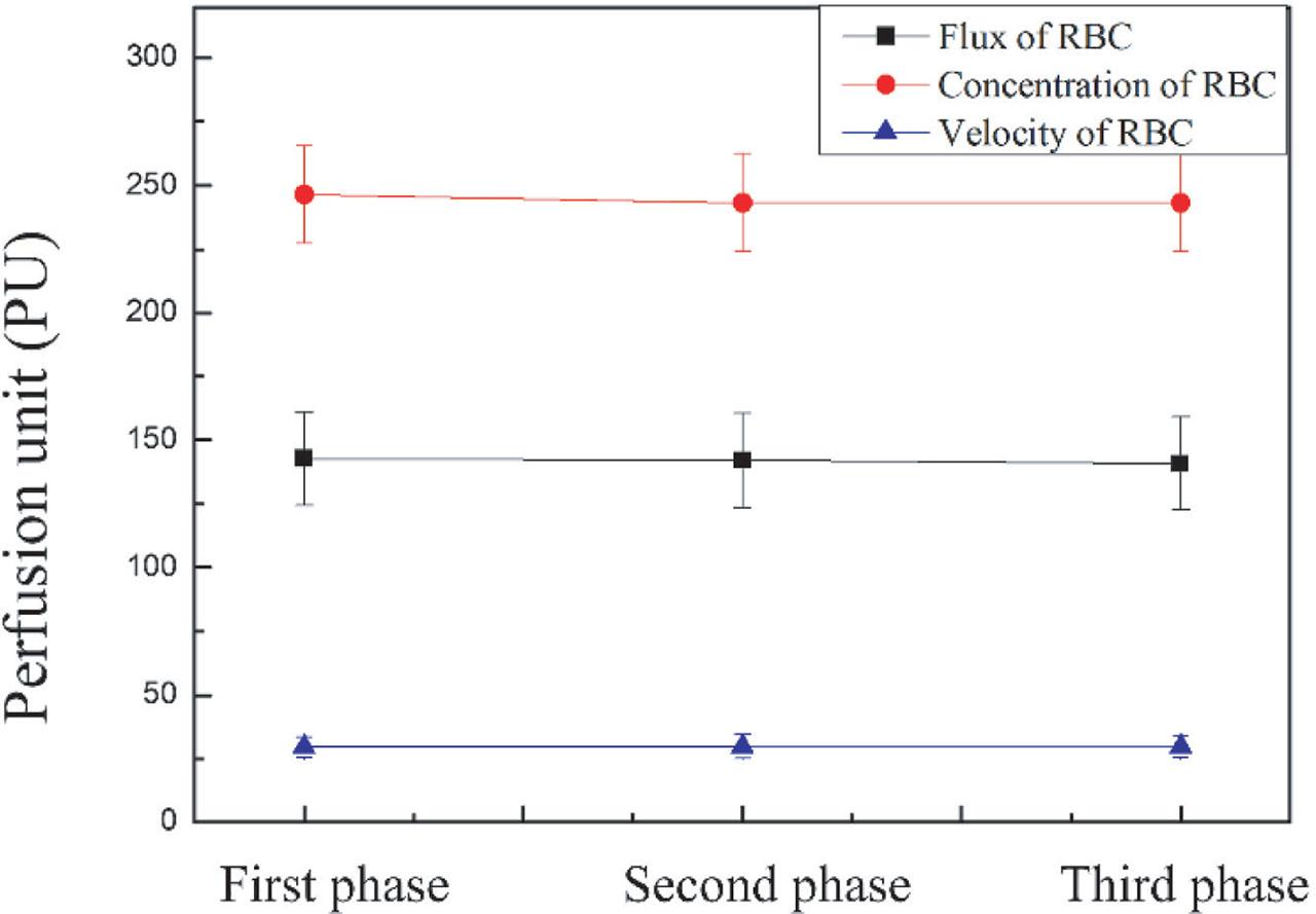 The variation of average microcirculation of AVF in HD patients with 830 nm laser (First phase: baseline; Second phase: 830 nm laser radiated on palm for 20 min; and Third phase: after the cessation of the 830 nm laser). AVF, arteriovenous fistula; HD, hemodialysis.