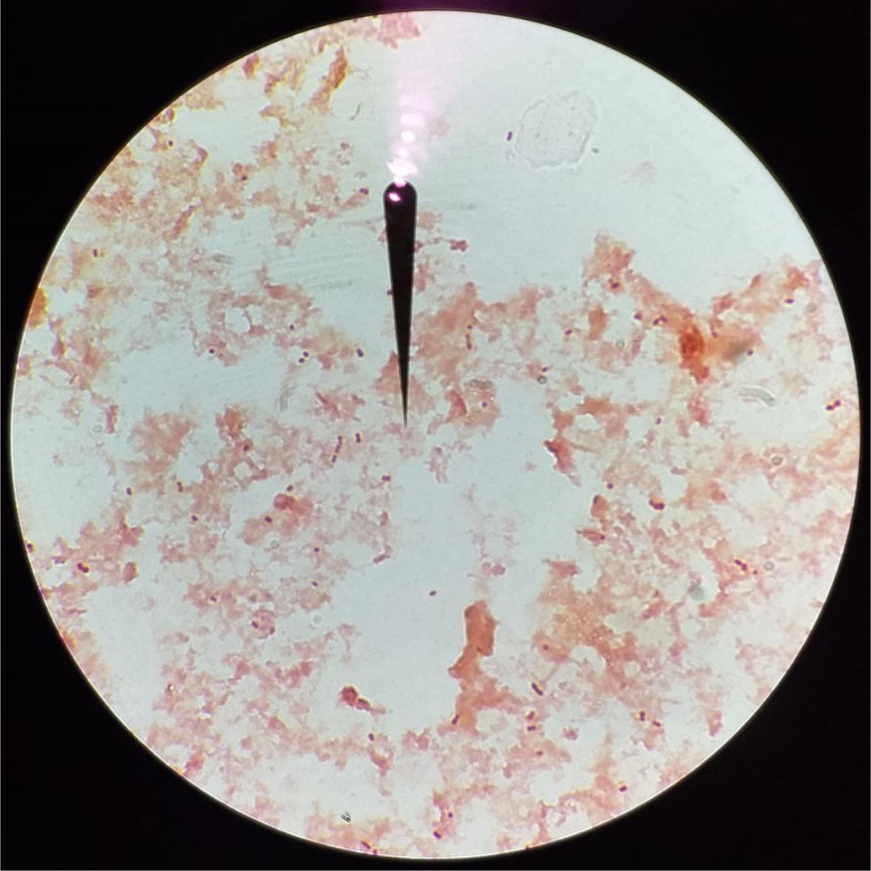 Microscope view of gram-stained Psychrobacter sp. described in the report.