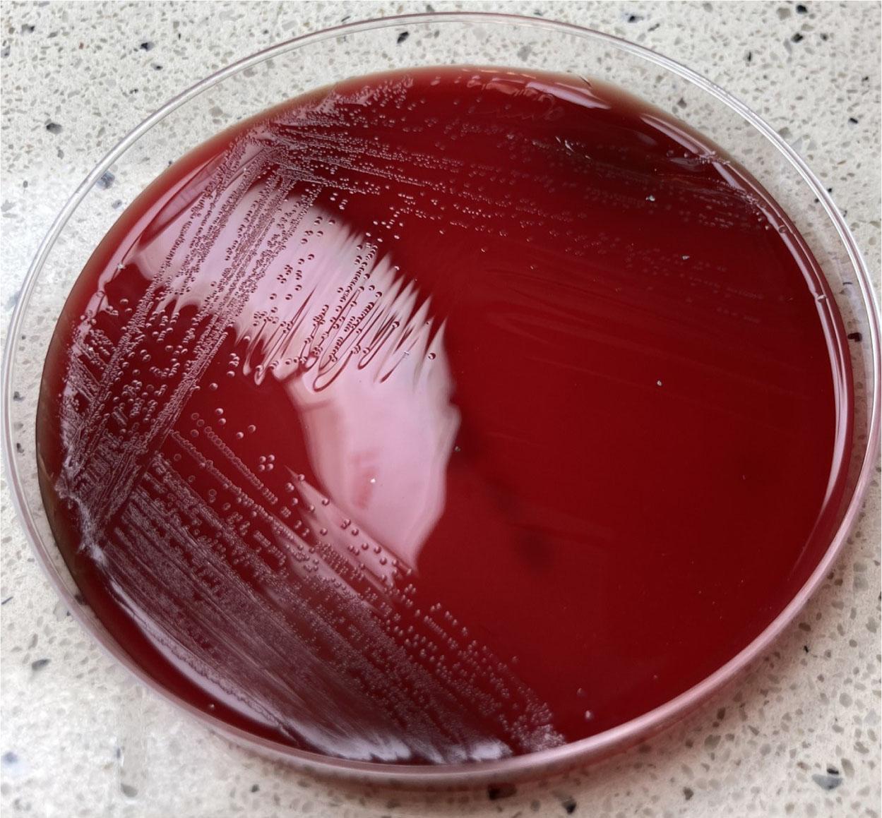 The growth of Psychrobacter sp. described in the report on Columbia Agar with 5% sheep blood.
