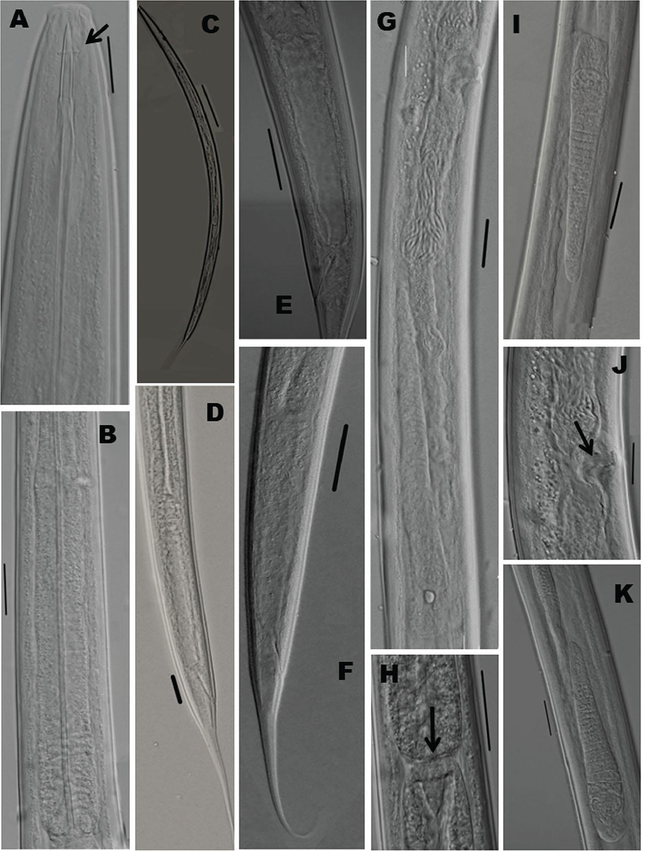 Laimydorus siddiqii (Female) from Uttarakhand, India (light microscopy). A: Anterior region with double guiding ring (arrowed); B: Pharyngeal expansion; C: Entire female; D: Posterior region; E: Prerectum; F: Tail region; G: Genital system; H: Cardiac region; I: Anterior ovary J: Vagina (arrowed); K: Posterior ovary. Scale bars: (A,G,H,I,K), 10 μm; (B,D,E,F) 20 μm; (C)100 μm.