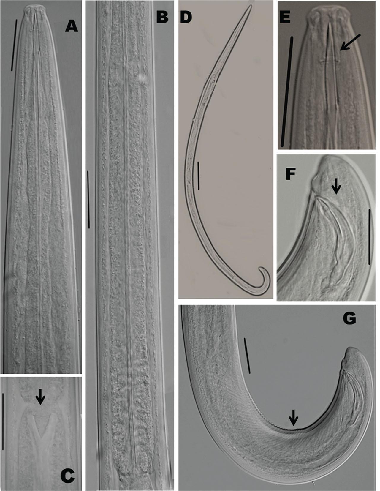 Laimydorus siddiqii (Male) from Uttarakhand, India (light microscopy). A: Anterior body region; B: Pharyngeal expansion; C: Pharyngointestinal junction; D: Entire male; E: Anterior region with double guiding ring; F: Spicules; G: Posterior body region; Scale bars: (A,E,C), 10 μm; (D) 100 μm; (B,F,G), 20 μm.