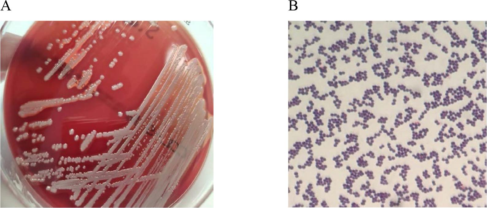 In vitro cultures of Staphylococcus aureus on Columbia Agar with 5% sheep blood (A) and a Gram-stained preparation of Staphylococcus aureus viewed under a light microscope (magnification x1000). Source: own elaboration.