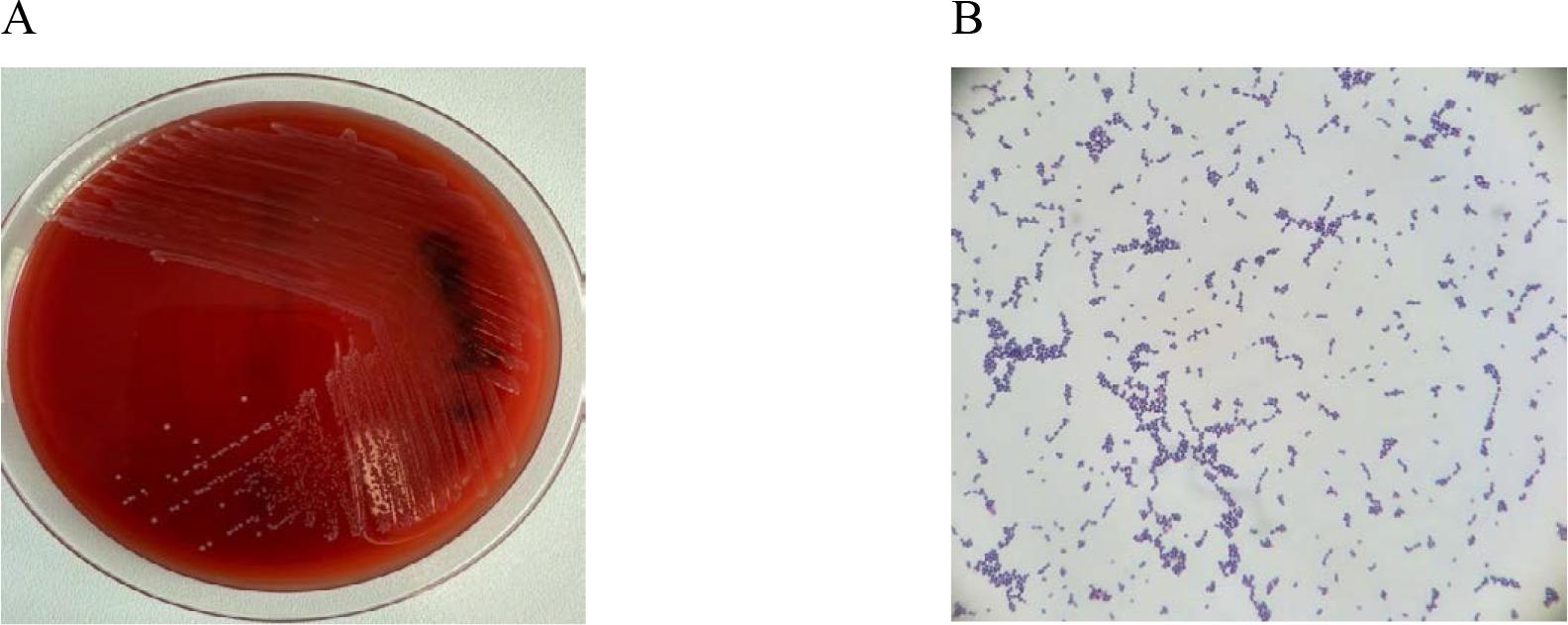 In vitro cultures of Enterococcus faecalis on Columbia Agar with 5% sheep blood (A) and a Gram-stained preparation of Enterococcus faecalis viewed under a light microscope (magnification x1000). Source: own elaboration.